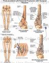 orthopedics transcription